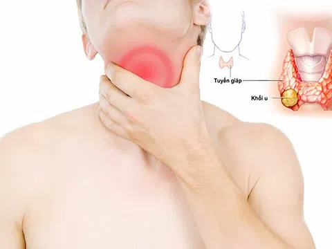 Sự “lệch pha” giữa quy định pháp lý và thực tiễn y khoa trong việc xác định tỷ lệ thương tật, nghề nghiệp trong khám chữa bệnh